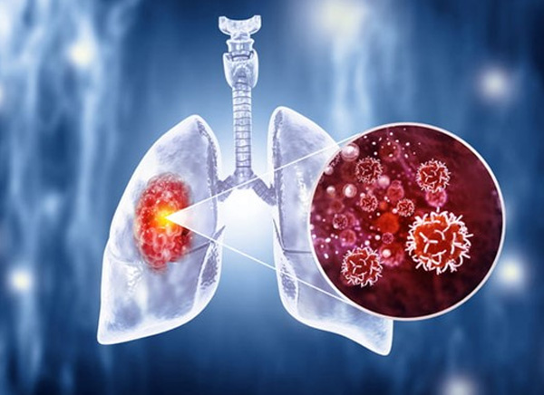 Pulmonologist & Chest Physician in Santacruz